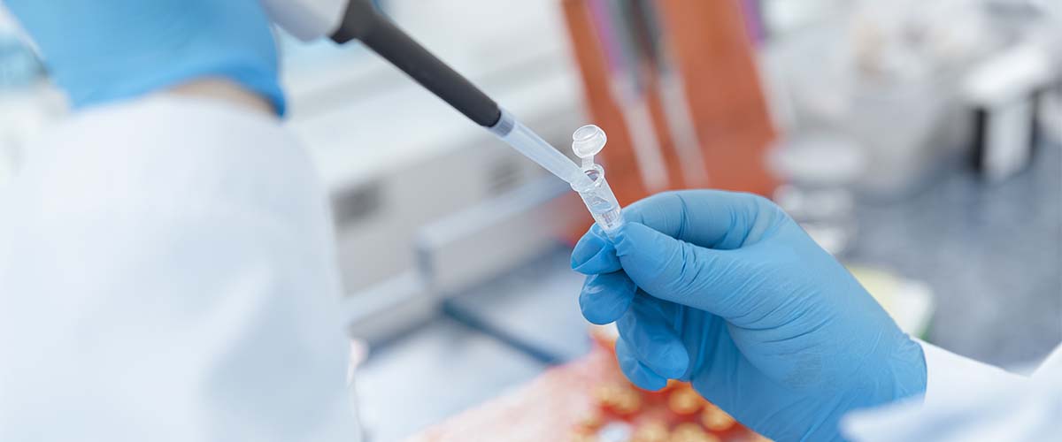 Immunolog